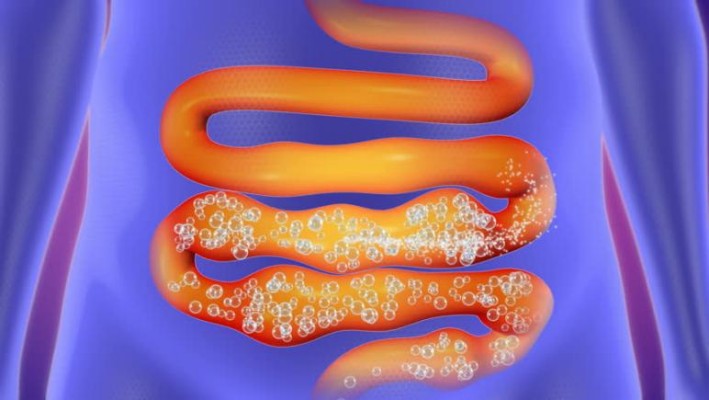 Intestino Irritado e Colite